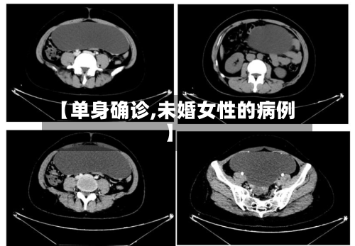 【单身确诊,未婚女性的病例】