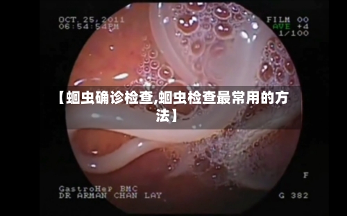 【蛔虫确诊检查,蛔虫检查最常用的方法】-第2张图片