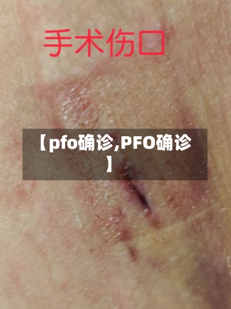 【pfo确诊,PFO确诊】