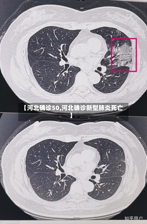 【河北确诊50,河北确诊新型肺炎死亡】-第2张图片