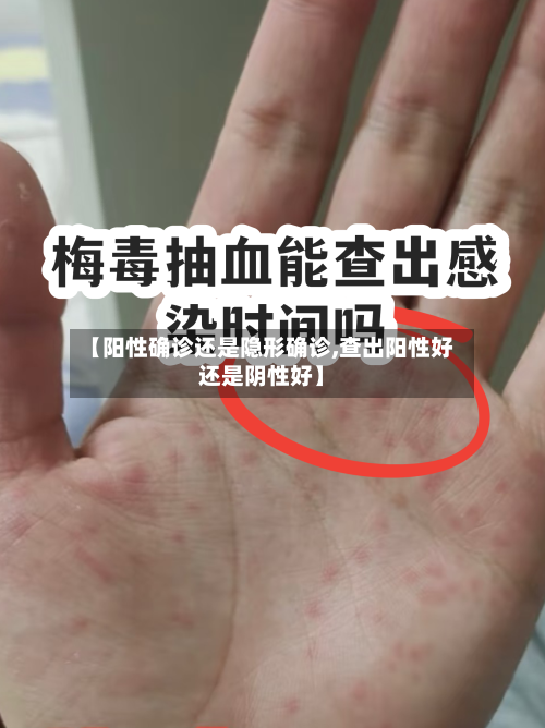 【阳性确诊还是隐形确诊,查出阳性好还是阴性好】