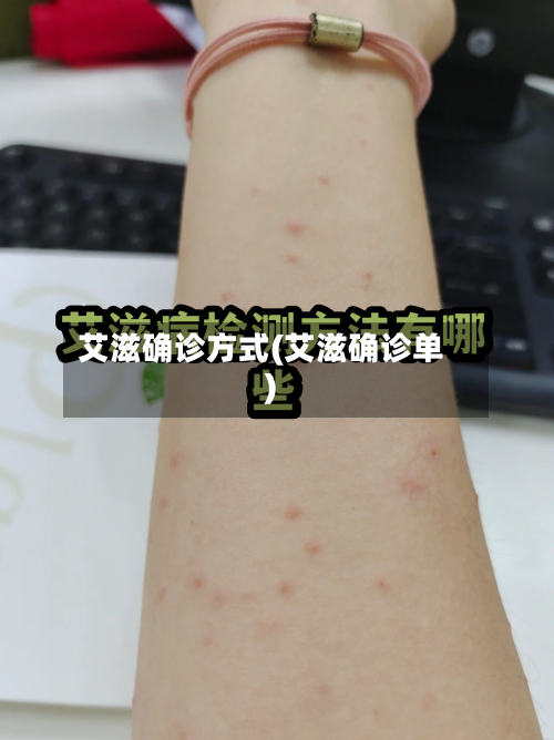 艾滋确诊方式(艾滋确诊单)
