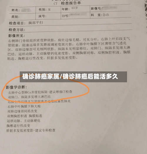 确诊肺癌家属/确诊肺癌后能活多久-第3张图片
