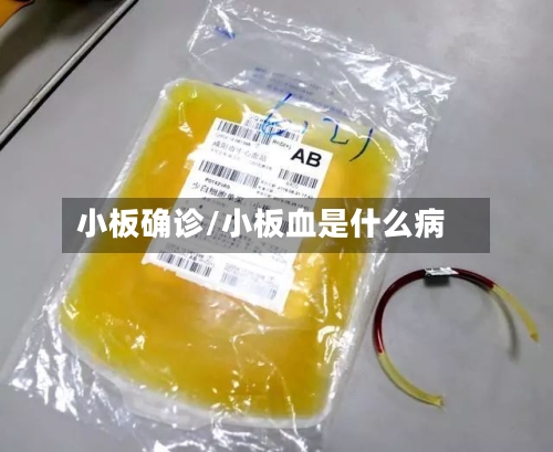 小板确诊/小板血是什么病-第2张图片