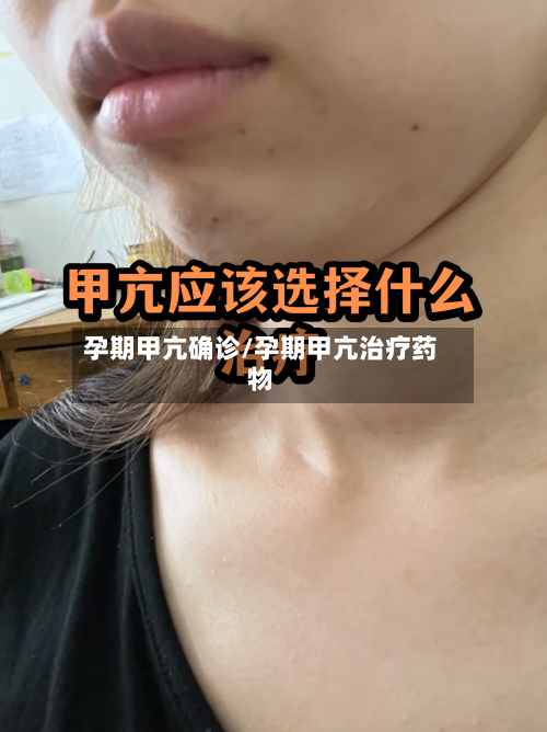 孕期甲亢确诊/孕期甲亢治疗药物-第2张图片
