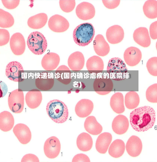国内快递确诊(国内确诊虐疾的医院排名)
