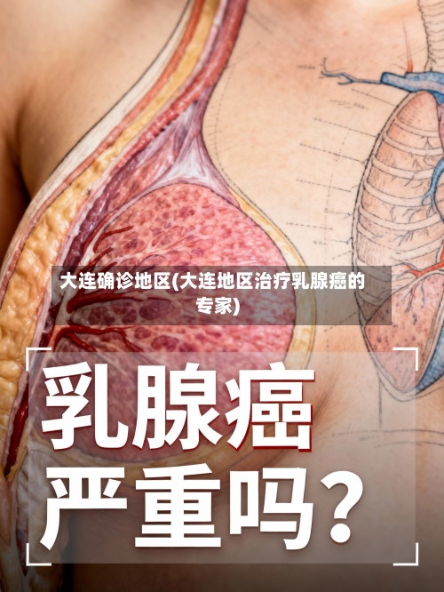 大连确诊地区(大连地区治疗乳腺癌的专家)-第2张图片