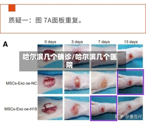 哈尔滨几个确诊/哈尔滨几个医院-第2张图片