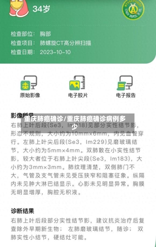重庆肺癌确诊/重庆肺癌确诊病例多少-第3张图片