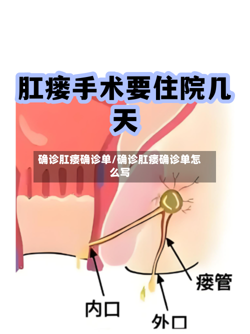 确诊肛瘘确诊单/确诊肛瘘确诊单怎么写-第2张图片