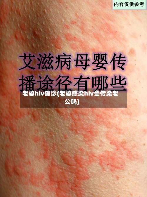老婆hiv确诊(老婆感染hiv会传染老公吗)-第3张图片
