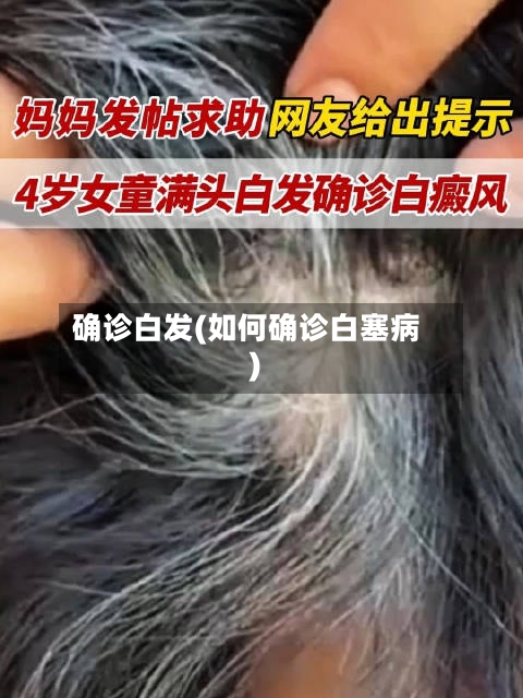 确诊白发(如何确诊白塞病)-第2张图片