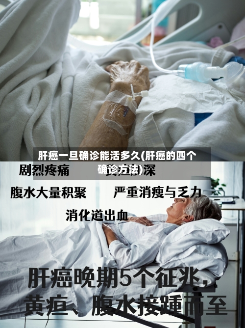 肝癌一旦确诊能活多久(肝癌的四个确诊方法)-第2张图片