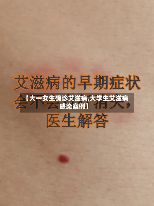【大一女生确诊艾滋病,大学生艾滋病感染案例】