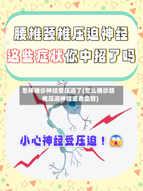怎样确诊神经受压迫了(怎么确诊颈椎压迫神经或者血管)-第2张图片