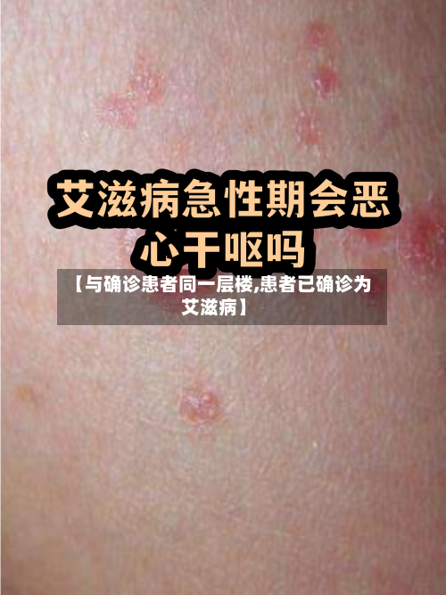 【与确诊患者同一层楼,患者已确诊为艾滋病】-第3张图片